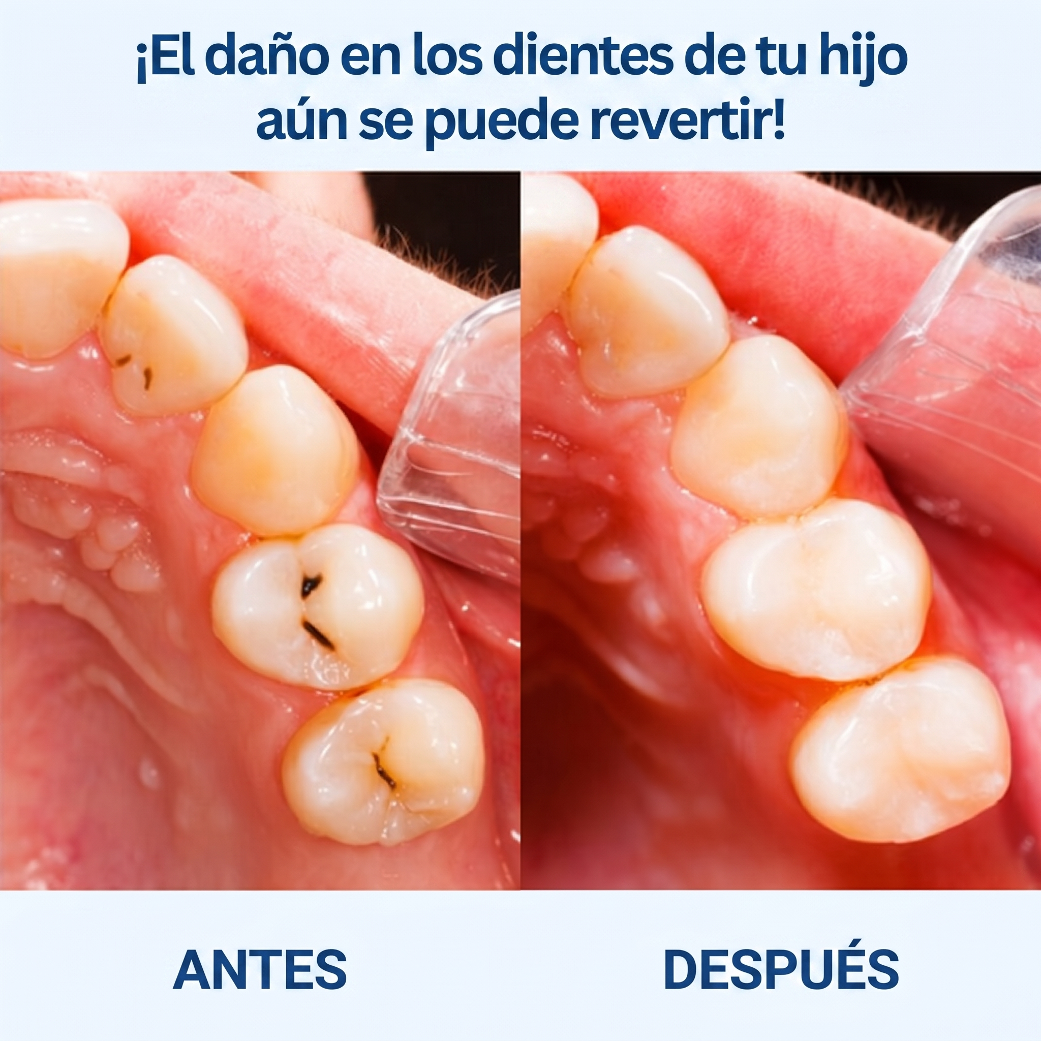CareChew® Gomitas Anticaries